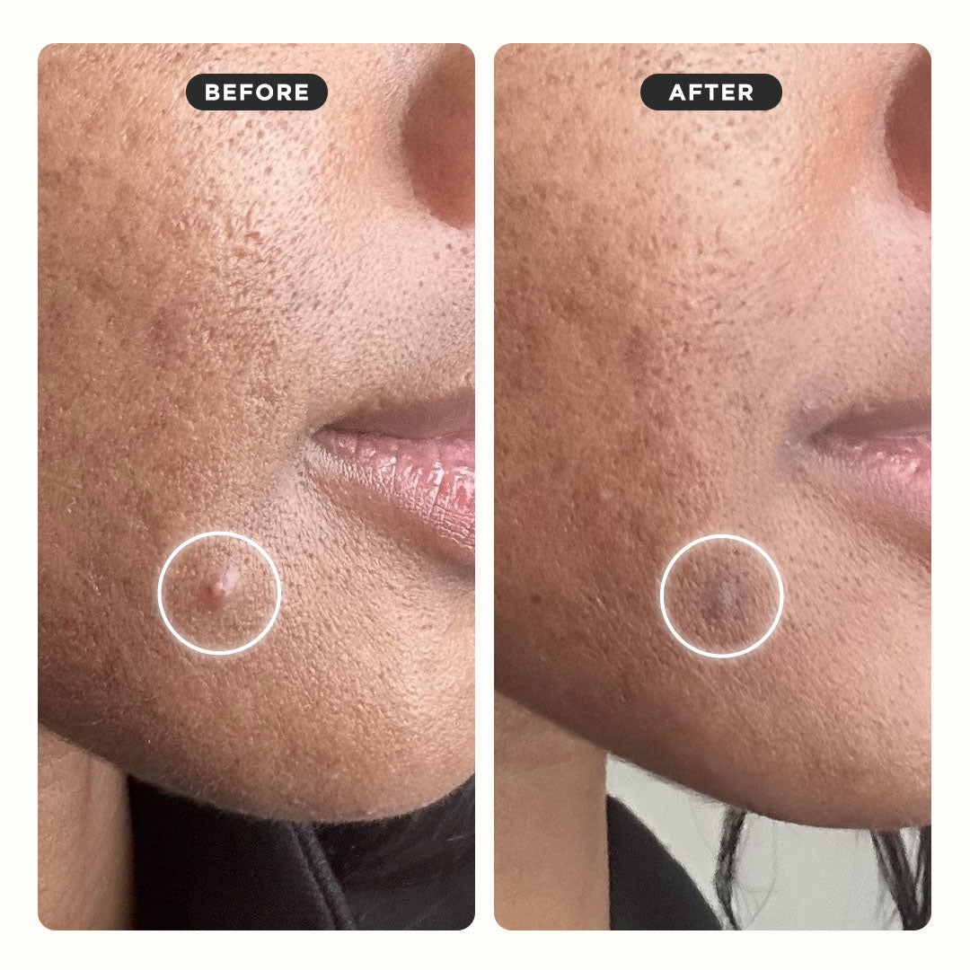 Iconic Duo - 20-pack - Monthly